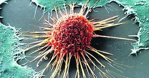 cancer cell image